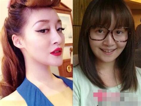 徐海星整容前后对比照片 徐海星整容背后那些不得不说的故事(2)