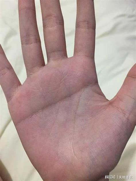 断掌纹图片命运图解,断掌是福还是祸全凭个人解读